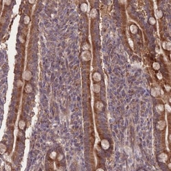 SLC35B4 Antibody, Novus Biologicals:Antibodies:Primary Antibodies